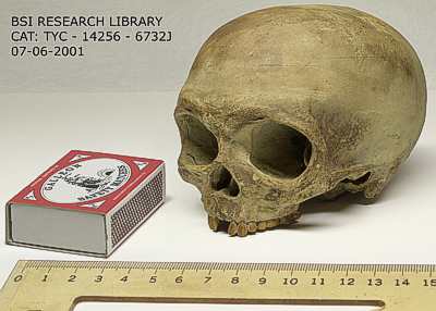 Furlington Skull